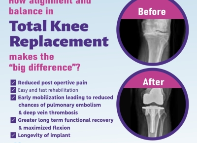 1_Best-orthopaedic-surgeon-in-faridabad-4