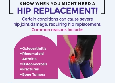 2_Best-orthopaedic-surgeon-in-faridabad-6