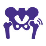 Osteoarthritis of the Hip