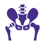 Total Hip Replacement