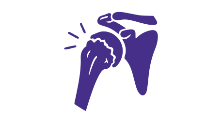 Shoulder Arthritis