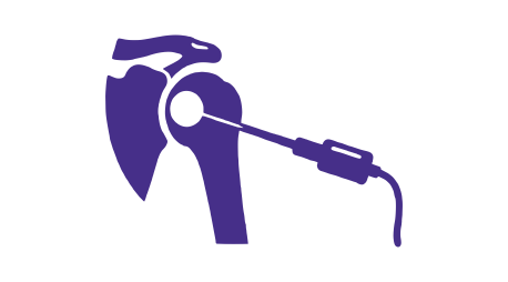 Shoulder Arthroscopy