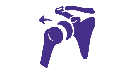 Shoulder Dislocation