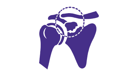 Slap Tear